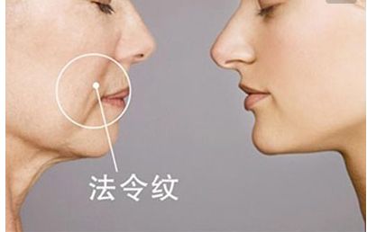 長沙田毅雙眼皮手術(shù)新穎獨(dú)特，引領(lǐng)2023最新潮流