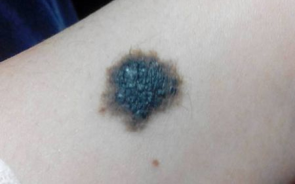 深圳青逸植發(fā)醫(yī)院技術(shù)好不好？醫(yī)生團(tuán)隊(duì)如何？能否令人信任？