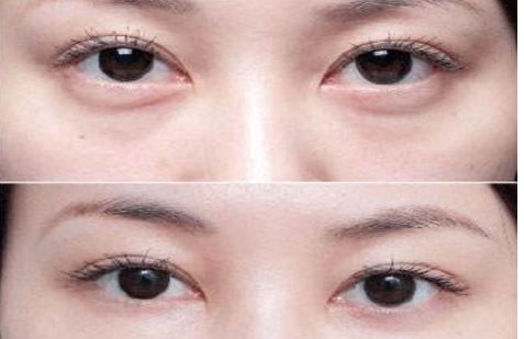 沈陽哪個(gè)醫(yī)院的整形專家口碑好，醫(yī)術(shù)高超的醫(yī)生推薦