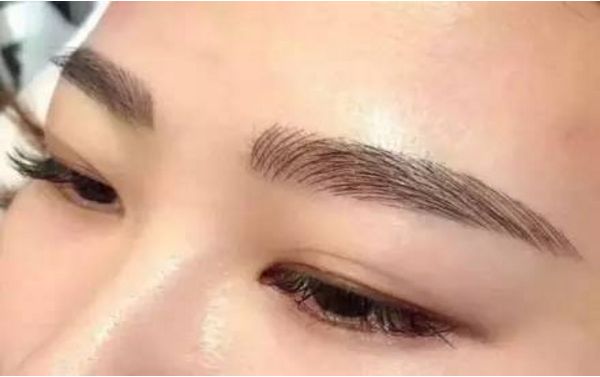 何晉龍磨骨成功，面容煥然一新！讓人難以置信的手術效果！