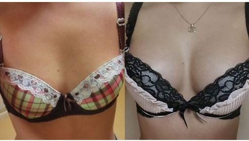 湖南地區(qū)雙眼皮手術(shù)醫(yī)生排行榜單盛裝亮相！提供熱門名醫(yī)推薦供您選擇！