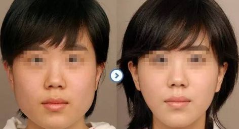 昆明頂尖眼部醫(yī)生一覽：驚人實(shí)力的前五位專家名單曝光