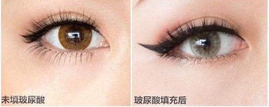 昆明市尋找雙眼皮醫(yī)生，這六位專家口碑爆棚！技術(shù)高超讓你滿意！