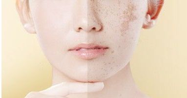 重慶新銅雀臺整形美容醫(yī)院褚健醫(yī)生的面部填充技術(shù)及真實案例分享