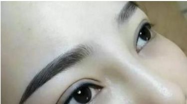 河北哪家醫(yī)院有好的雙眼皮手術推薦，整形醫(yī)院名單分享~