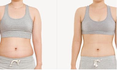 協(xié)和醫(yī)院提供熱瑪吉和超生炮手術，專家推薦！手術費用一覽表僅參考！