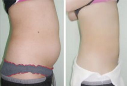 長(zhǎng)沙哪家拉皮手術(shù)醫(yī)院靠譜？幾家實(shí)力口碑不錯(cuò)，快來看看