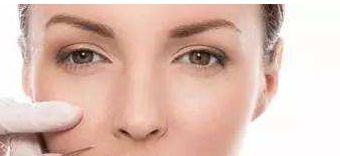 浙醫(yī)二院薛旦雙眼皮效果及價(jià)格詳情，醫(yī)生特長(zhǎng)與病例分享