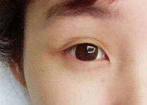 2023寧波隆鼻醫(yī)生排行榜：張廣巍、任森洋、肖慶華五位備受矚目的醫(yī)師解析及收費(fèi)信息！