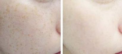 2023昆明下頜角整形臉部護理達人該怎么樣選擇？陳曦、錢靜、楊保祥等讓您信賴！