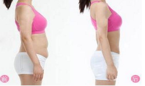 西安植發(fā)機(jī)構(gòu)推薦榜單發(fā)布！專家揭秘植發(fā)費(fèi)用福利