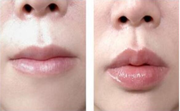 北京柏麗整形醫(yī)院的整形效果如何？有哪些專(zhuān)家醫(yī)生可以選擇？