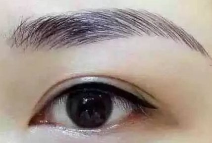 各路醫(yī)生實力大比拼！同帥與楊亞益，誰在雙眼皮手術(shù)上更出彩？