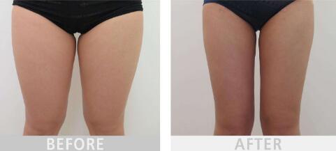 2023年德化縣醫(yī)院整形外科價目表是否已經(jīng)公布？鄭向陽的口碑和經(jīng)驗如何進行深度評點？案例欣賞？