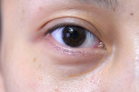 深圳北大醫(yī)院美容皮膚科的詳細資料是什么？如何了解更多有關(guān)深圳北大醫(yī)院美容皮膚科的信息？