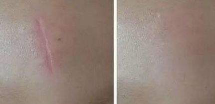 唐毅整形外科醫(yī)生胸部整形術(shù)效果如何？附最新出診信息