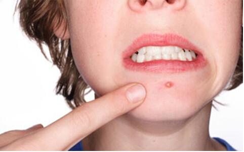 貴陽(yáng)激光祛斑公立醫(yī)院哪家費(fèi)用透明可信賴？2023更全排行榜！