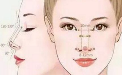 注射雙美膠原蛋白隆鼻的優(yōu)點(diǎn)有哪些？