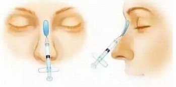 上海五位備受矚目的雙眼皮修復(fù)專(zhuān)家，讓你放心選擇