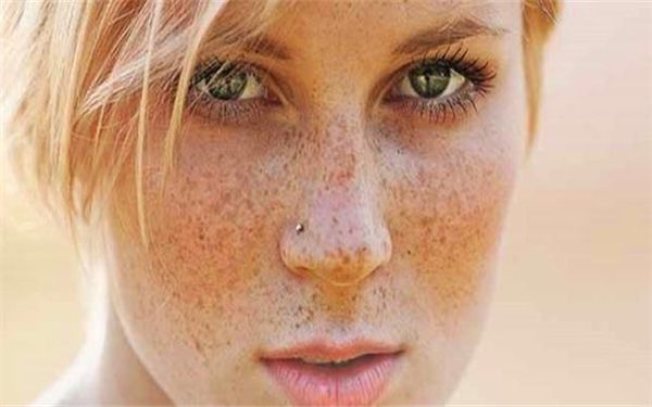 王振軍雙眼皮修復(fù)獨(dú)特個案分享，展現(xiàn)多款風(fēng)格圖片！