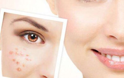 羅瀾濤醫(yī)生的鼻部整形效果如何？醫(yī)師簡(jiǎn)介與花式鼻子案例分享，價(jià)格目錄供參考