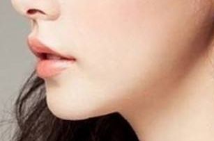 2023天津雙眼皮修復(fù)：醫(yī)生排名與技術(shù)對(duì)比，袁強(qiáng)、衛(wèi)星、李小兵等人誰(shuí)更優(yōu)秀？