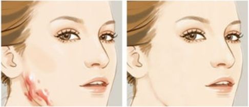 杭州市最受推崇的做雙眼皮手術(shù)的頂級醫(yī)院大全，技術(shù)高超、口碑出眾一網(wǎng)打盡