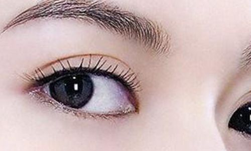 太玲美眸重現(xiàn)！揭秘雙眼皮新趨勢，驚艷效果讓人眼前一亮