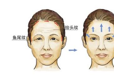 西京整形醫(yī)院：雙眼皮手術(shù)憑什么贏得專家認(rèn)可？親身經(jīng)歷分享