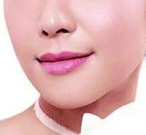 哪位西安醫(yī)生擅長(zhǎng)割雙眼皮，割雙眼皮技術(shù)如何？