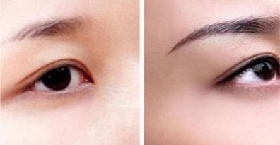 重慶頂尖眼部整形醫(yī)生、醫(yī)院排行榜一覽