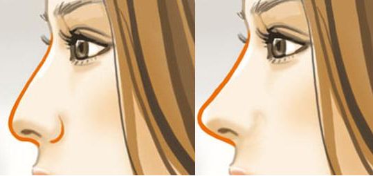 上海哪個醫(yī)院雙眼皮手術(shù)效果最自然？名醫(yī)名單和成功案例供參考