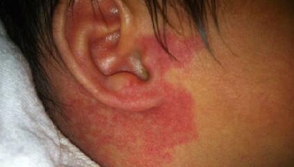 空軍總醫(yī)院整形科怎么樣？從隆鼻醫(yī)生到科普分享，真的那么靠譜嗎？