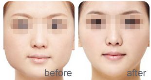 寧波美萊醫(yī)療美容?？频脑u價如何？全面解析李斌醫(yī)生的口碑反響！