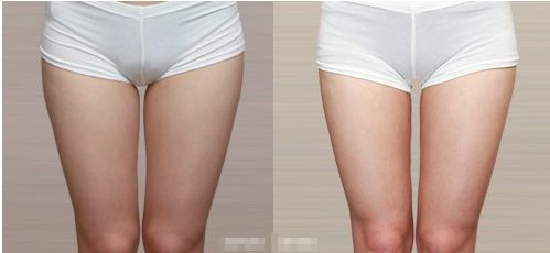 蘭州市口碑最佳醫(yī)美醫(yī)院綜合排名前三強勢揭曉