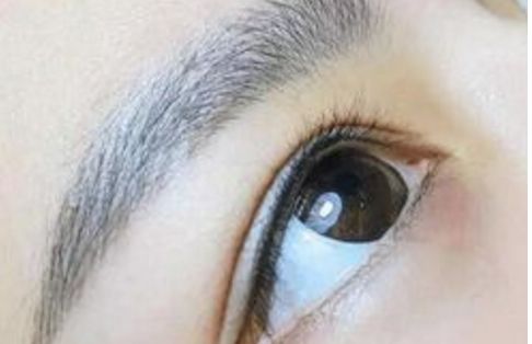 廣州名麗醫(yī)療美容醫(yī)院隆鼻案例分享：真實(shí)口碑大揭秘！