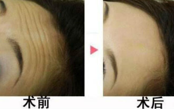 西安陽光整形醫(yī)院靠譜嗎？醫(yī)生背景和價格怎么樣？