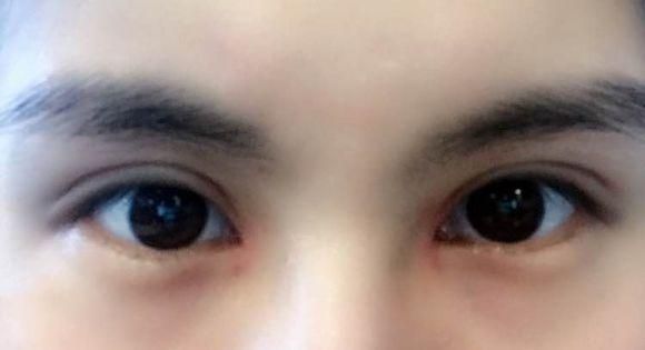 四川華西整形美容科醫(yī)生排行榜前五名，你不能錯過的權威專家！