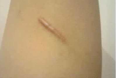 重慶最佳專業(yè)雙眼皮手術(shù)，醫(yī)生名單與真實(shí)案例圖震撼揭秘