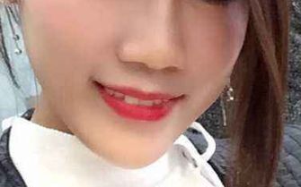 黃印資技術(shù)的鼻子風(fēng)格與個(gè)人資料+隆鼻案例