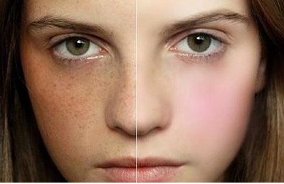 專(zhuān)業(yè)修復(fù)雙眼皮評(píng)論解析，醫(yī)生點(diǎn)評(píng)&網(wǎng)友手術(shù)對(duì)比曝光，必看照片分享