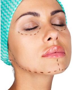 最新資訊！沈干專業(yè)雙眼皮技術(shù)揭秘，真實案例解析！