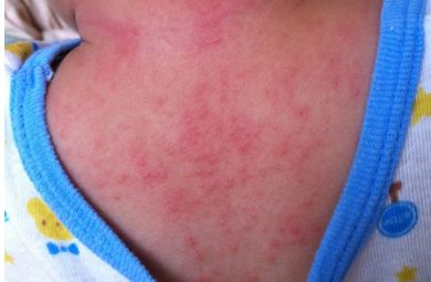 大家對(duì)重慶當(dāng)代整形醫(yī)院醫(yī)生謝錦清的技術(shù)有何評(píng)價(jià)？附有最新隆鼻案例和醫(yī)療解析