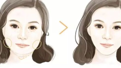 北京哪家整形醫(yī)院的隆鼻效果好？排行榜公開(kāi)！