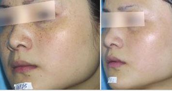 北京隆鼻醫(yī)療專家曝光！汪垟、王博謙、余恩旭等獨(dú)特風(fēng)格值得關(guān)注