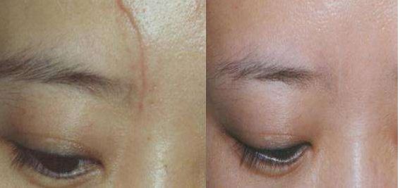 上海九院專業(yè)脂肪填充醫(yī)生排行榜前五名揭曉，想了解的速來(lái)！