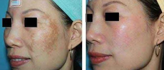 樂山整容醫(yī)院哪家效果好？專業(yè)對比與推薦！