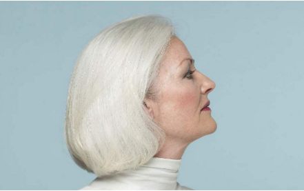 鄭州華領(lǐng)整形醫(yī)院豐胸效果一覽，2023瘦身成功故事詳解