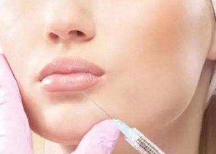 徐占鋒雙眼皮術(shù)后效果如何？專(zhuān)業(yè)醫(yī)生簡(jiǎn)介及真實(shí)案例分享