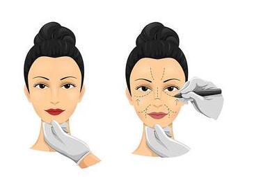 2023年權(quán)威武漢雙眼皮整形醫(yī)院排名TOP10公布，哪些醫(yī)療美容機(jī)構(gòu)獲口碑肯定？